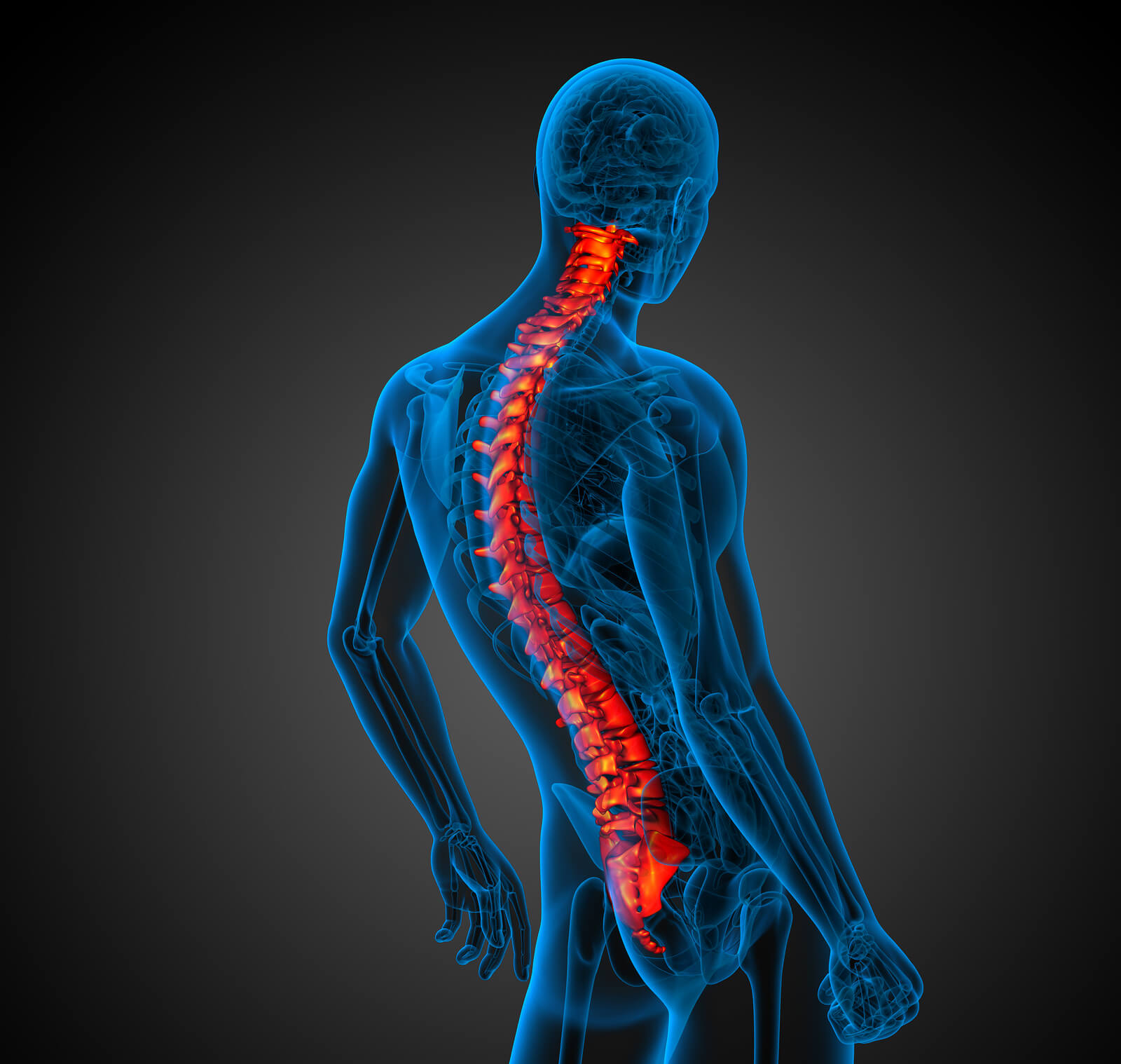 kelainan tulang belakang