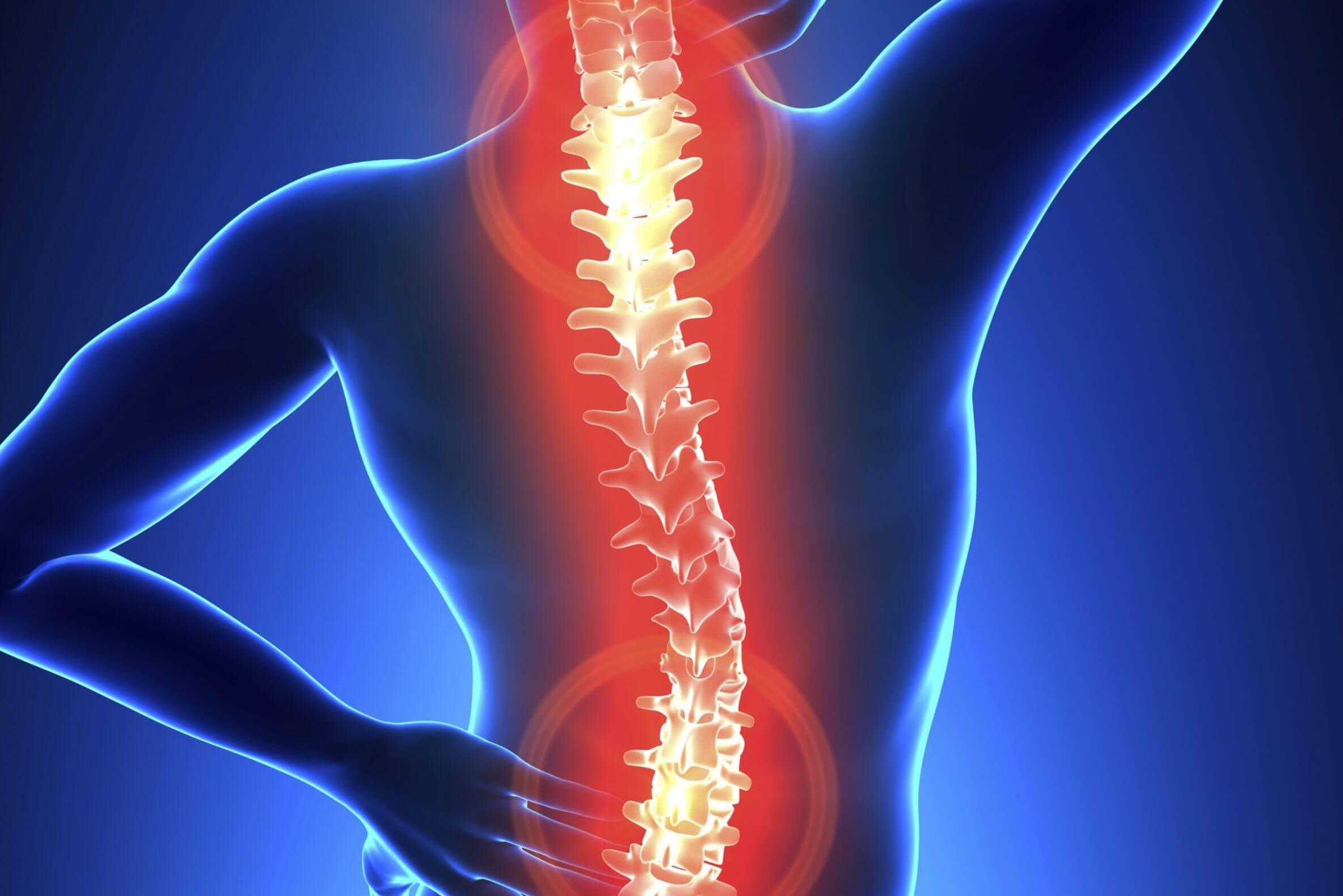 penyebab nyeri tulang belakang