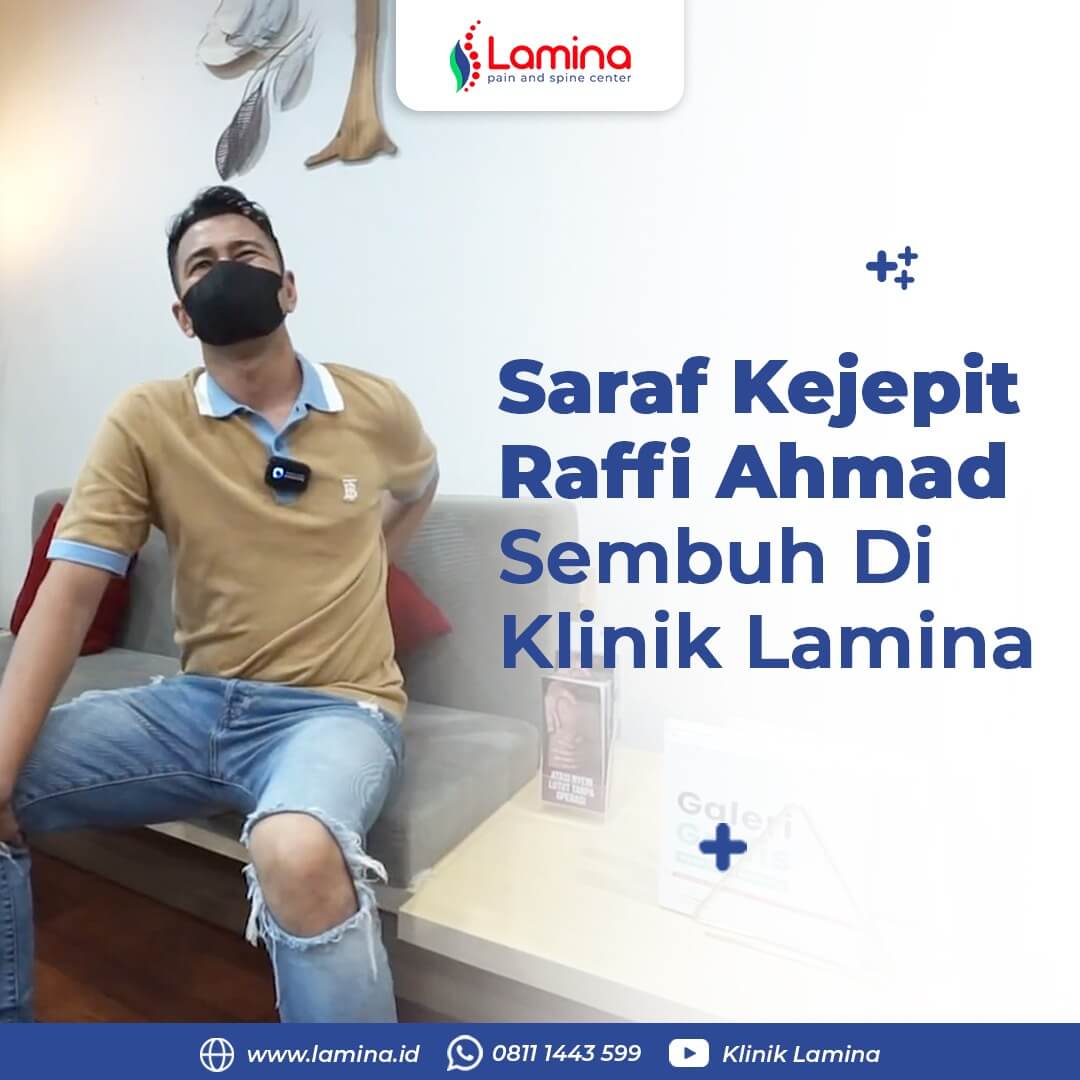 Saraf Kejepit Raffi Ahmad