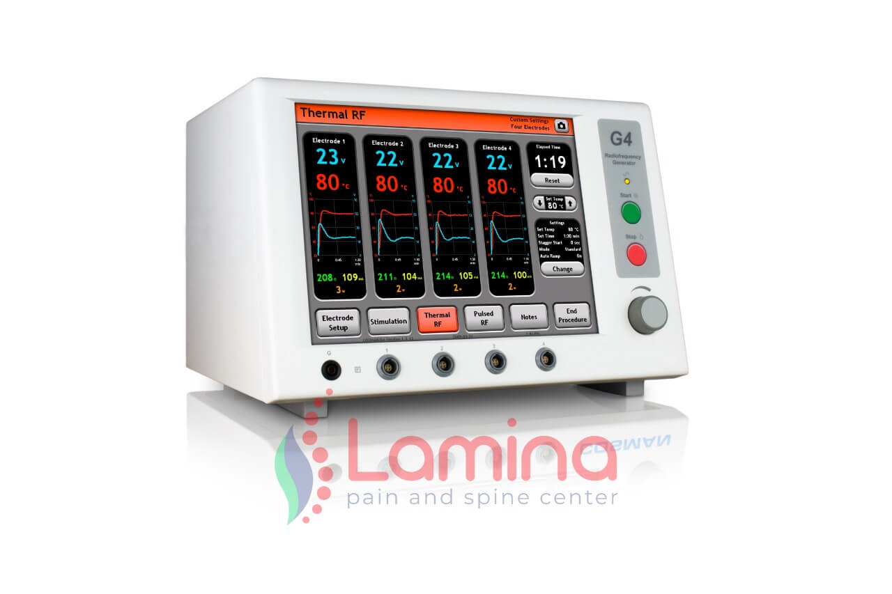 radiofrekuensi ablasi