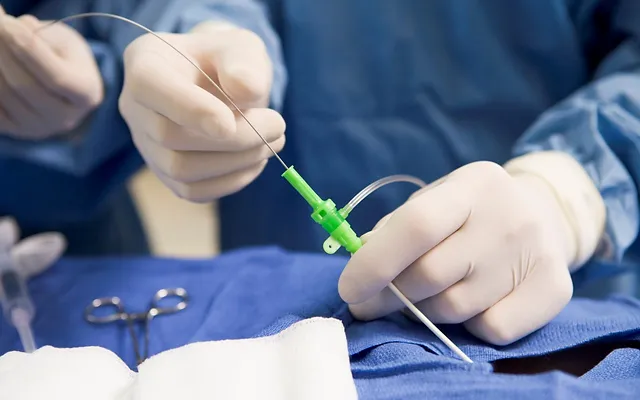 metode pengobatan saraf kejepit laser pldd lamina