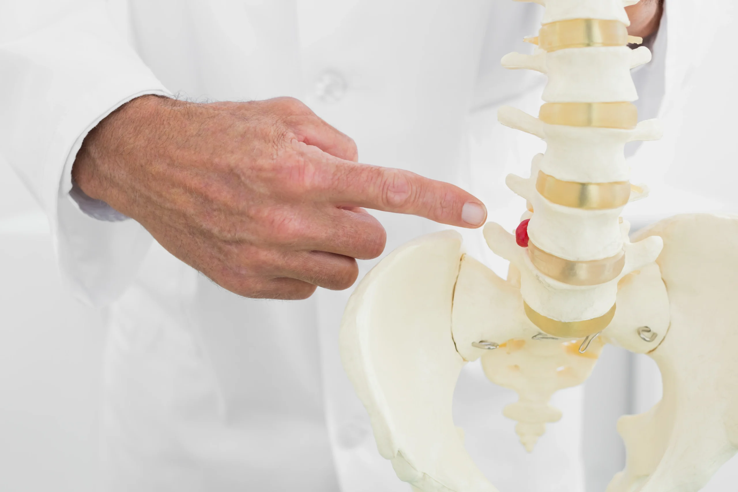 Kenali Ciri-ciri Radang Sendi Tulang Belakang - Lamina Pain and Spine Center