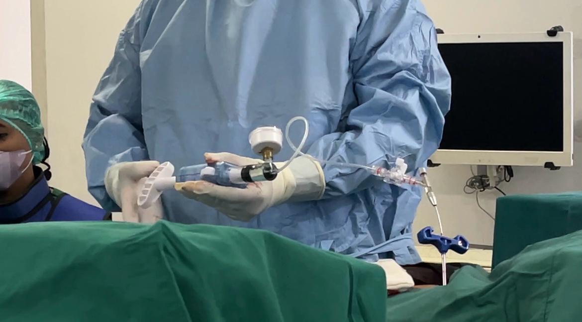 saraf kejepit di punggung bawah