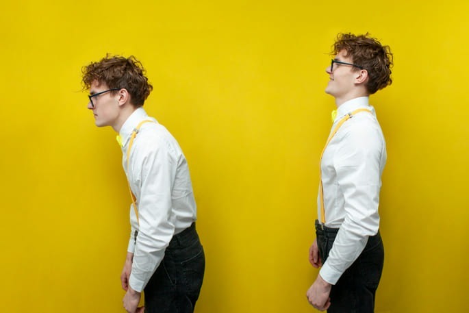 bagaimana jika gangguan kifosis semakin parah pada seseorang