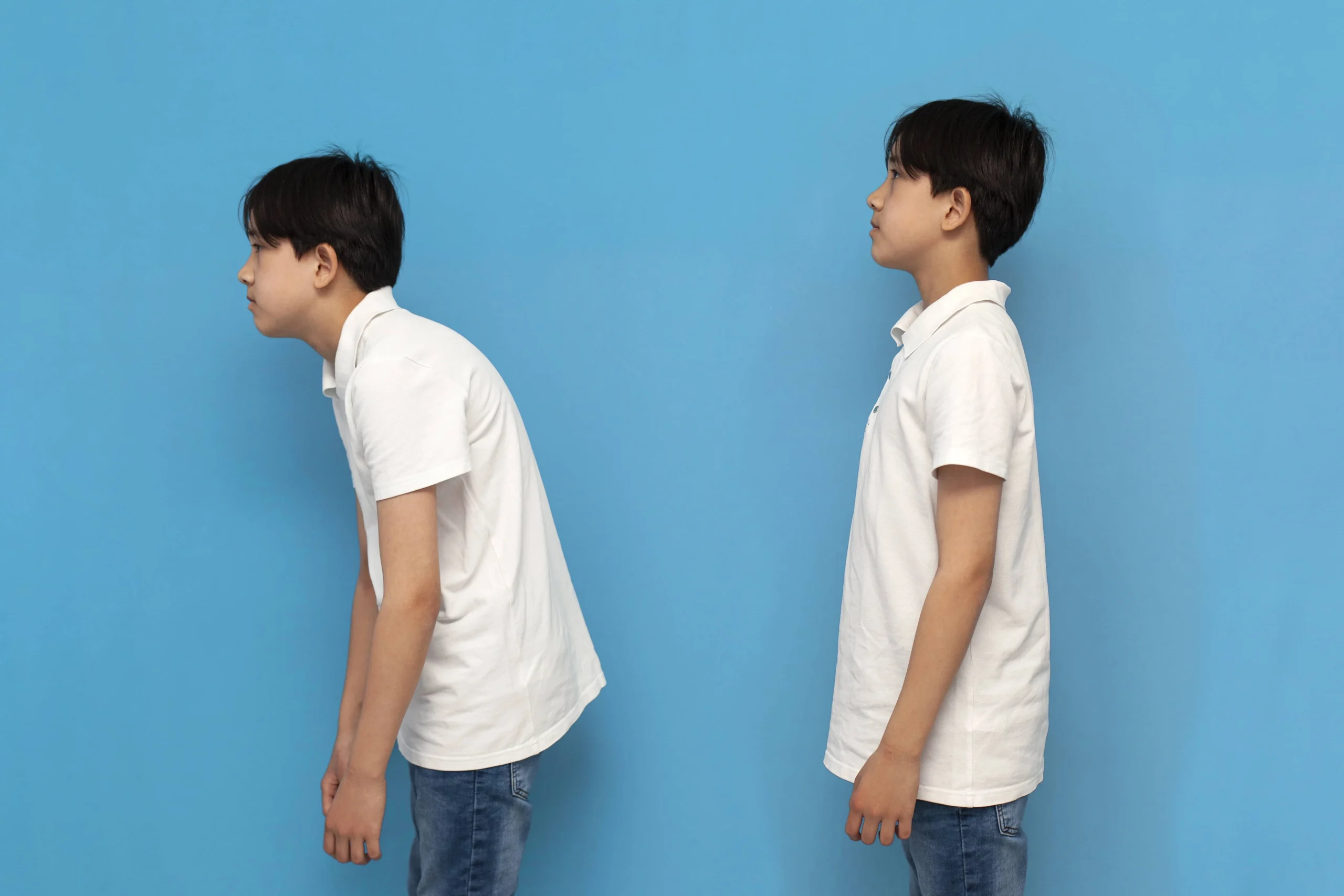 tulang bungkuk ke depan